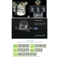 CYG108 Genoray PAPAYA Plus 3D CBCT Dental X-ray System - Denspay Dental - 
