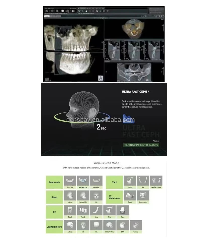 CYG108 Genoray PAPAYA Plus 3D CBCT Dental X-ray System - Denspay Dental - 