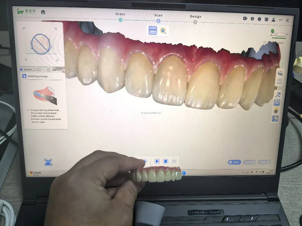 CYG109 3D Dental Scanner Intraoral 10μm 30fps - Denspay Dental - Intraoral Scanner