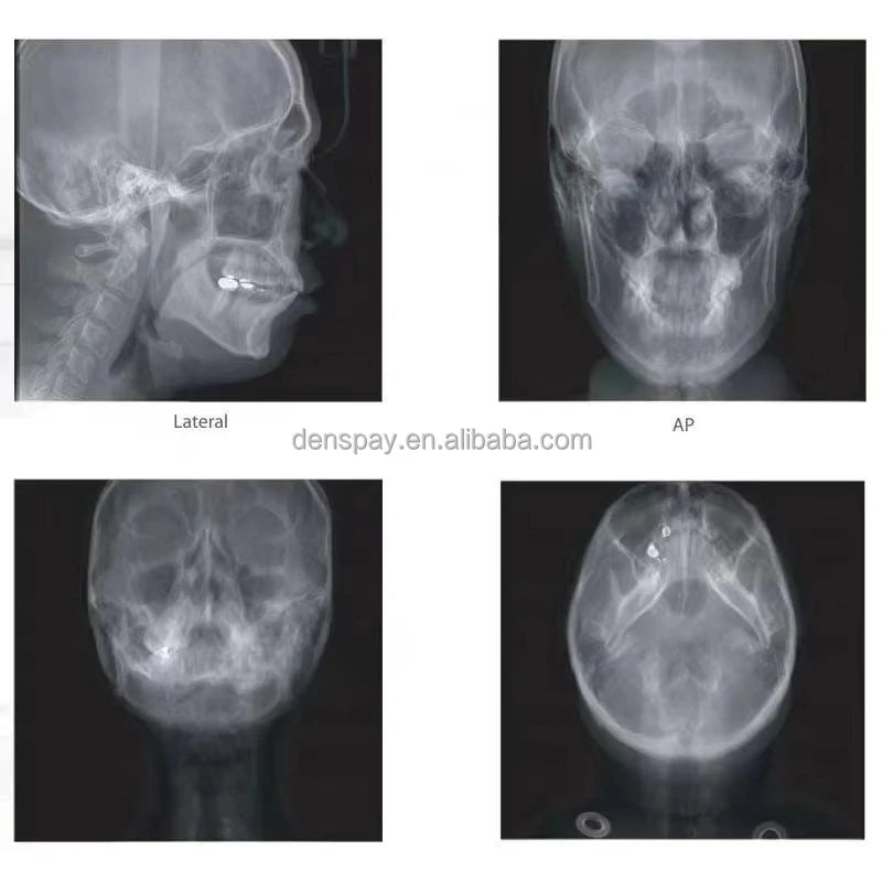CYG108 Genoray PAPAYA Plus 3D CBCT Dental X-ray System - Denspay Dental - 
