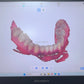 CYG109 3D Dental Scanner Intraoral 10μm 30fps - Denspay Dental - Intraoral Scanner