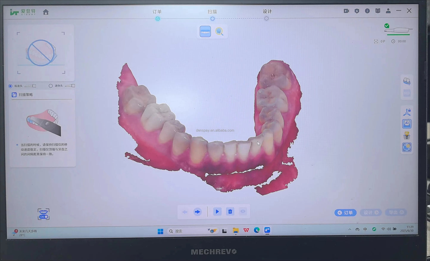 CYG109 3D Dental Scanner Intraoral 10μm 30fps - Denspay Dental - Intraoral Scanner