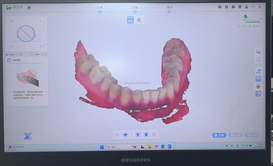 CYG109 3D Dental Scanner Intraoral 10μm 30fps - Denspay Dental - Intraoral Scanner