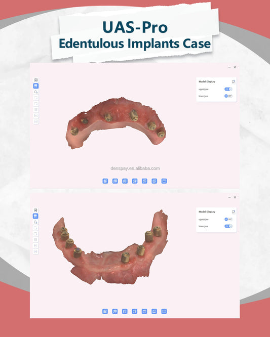 CYG107 Dental Intraoral Scanner 25mm Depth 3D Color - Denspay Dental - Intraoral Scanner