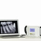 CYG062 Portable Dental X-ray Machine 60KV Toshiba Tube - Denspay Dental - 
