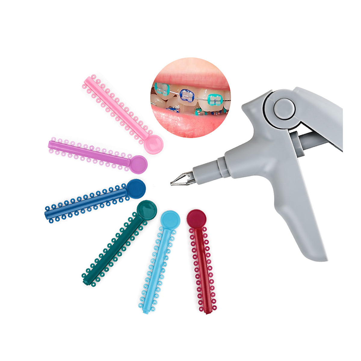 Intraoral effect, colored ligatures on braces in mouth