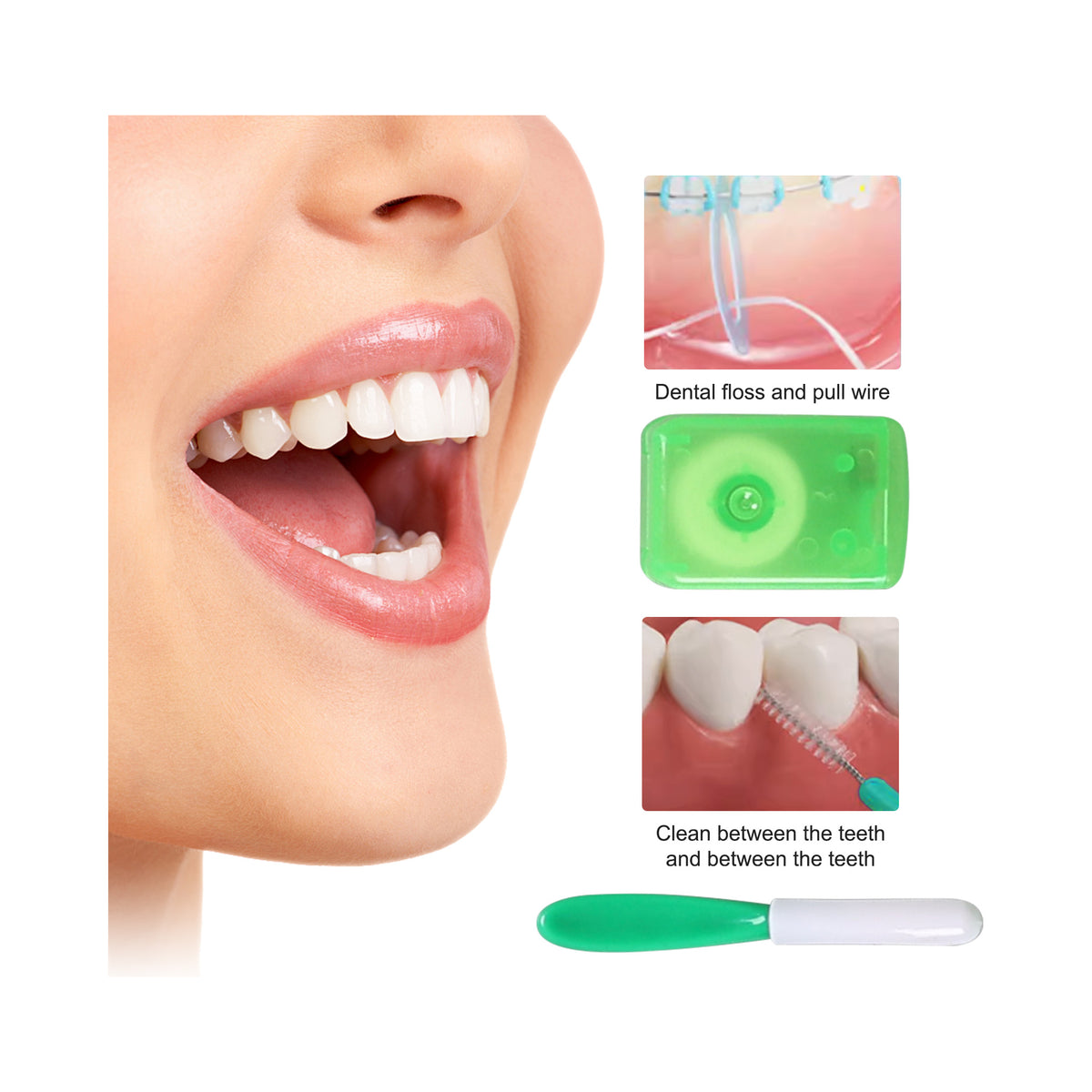 Intraoral cleaning effect schematic for braces patient