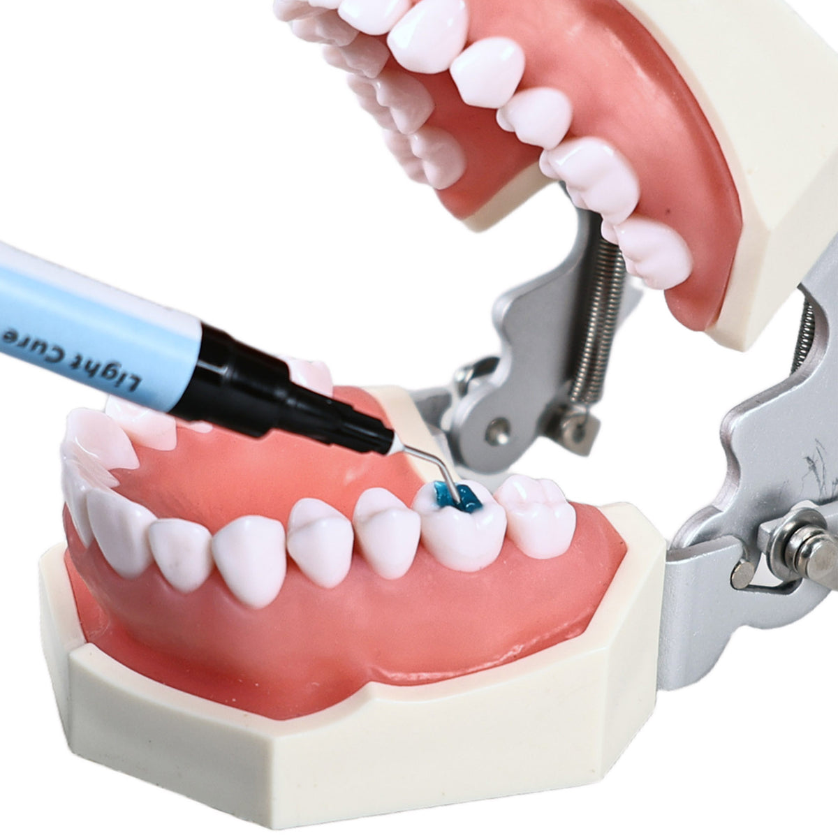 Light Curing Composite Restoration