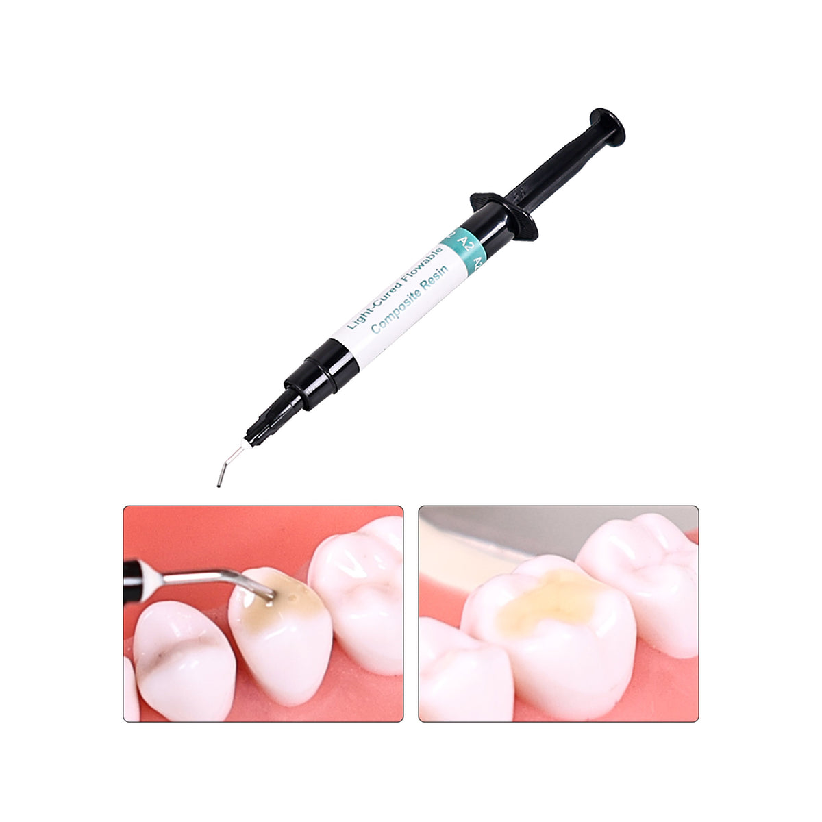 Light Curing Flow Composite Restoration