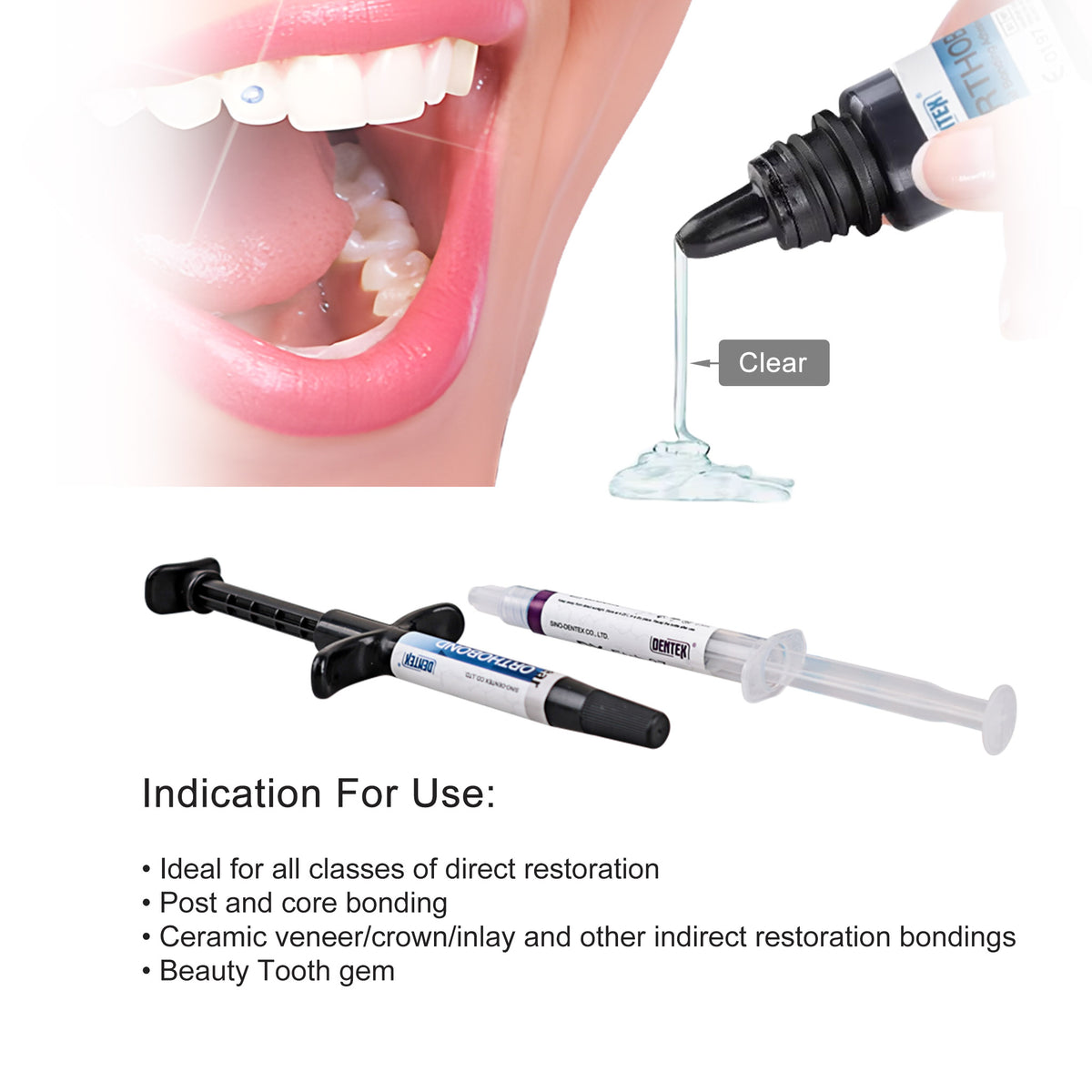 Light curing after bracket placement