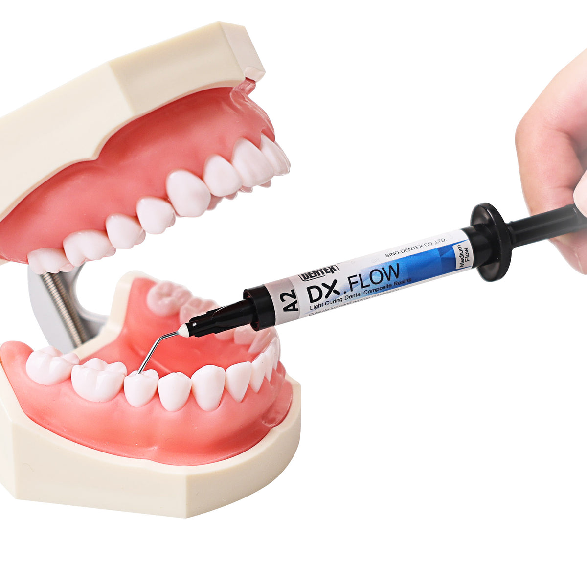 Posterior composite filling occlusal view