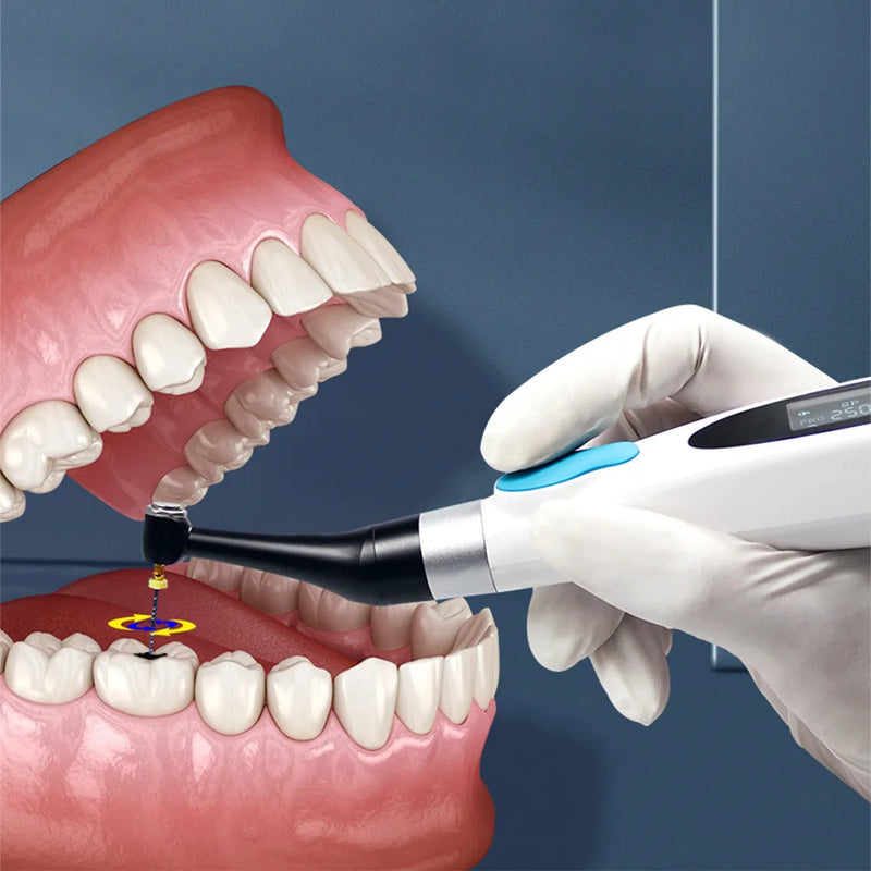 New 9 Programs Cordless Dental LED Endo Motor 16:1 Dental Reduction Contra Angle Dentistry Endodoncia Treatment Equipment Tools