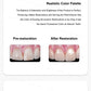 CYU059 Dental Ceramics