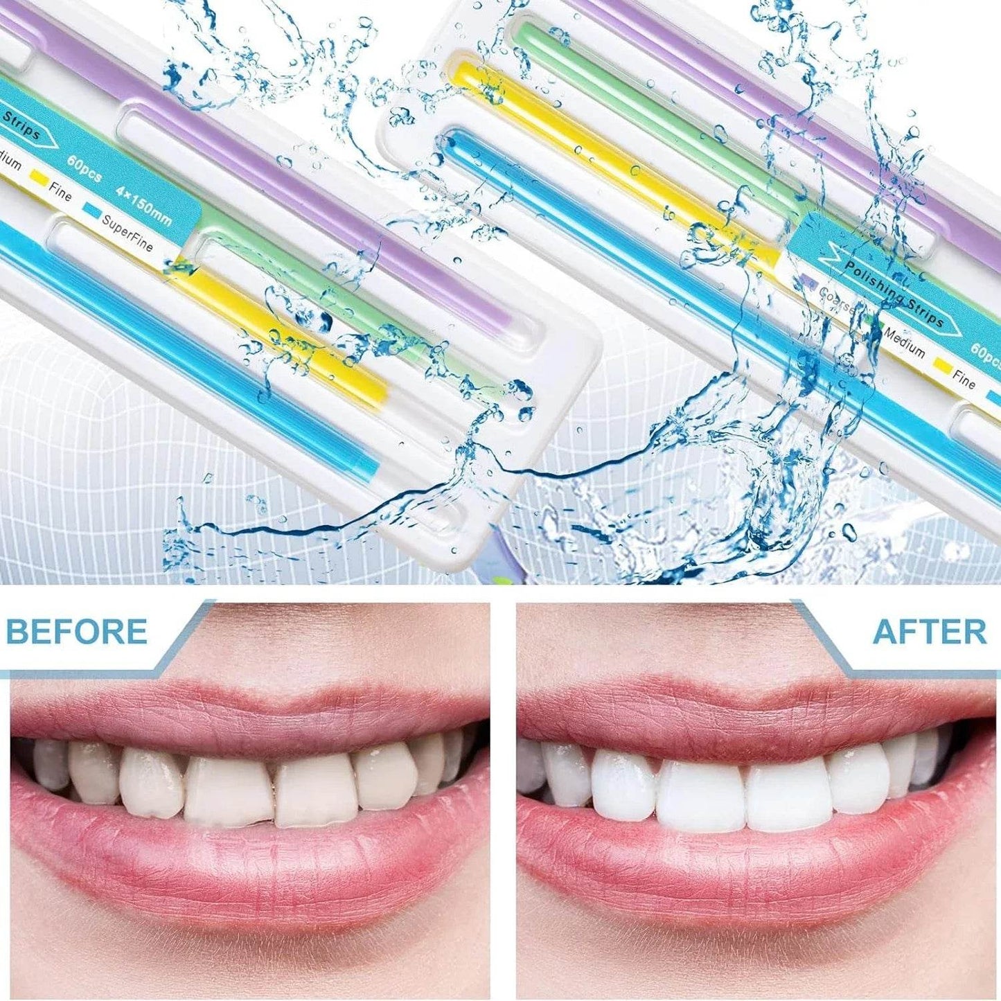 CYW807 Dental Polishing Strip - Denspay Dental - Universal Polishers & Abrasives