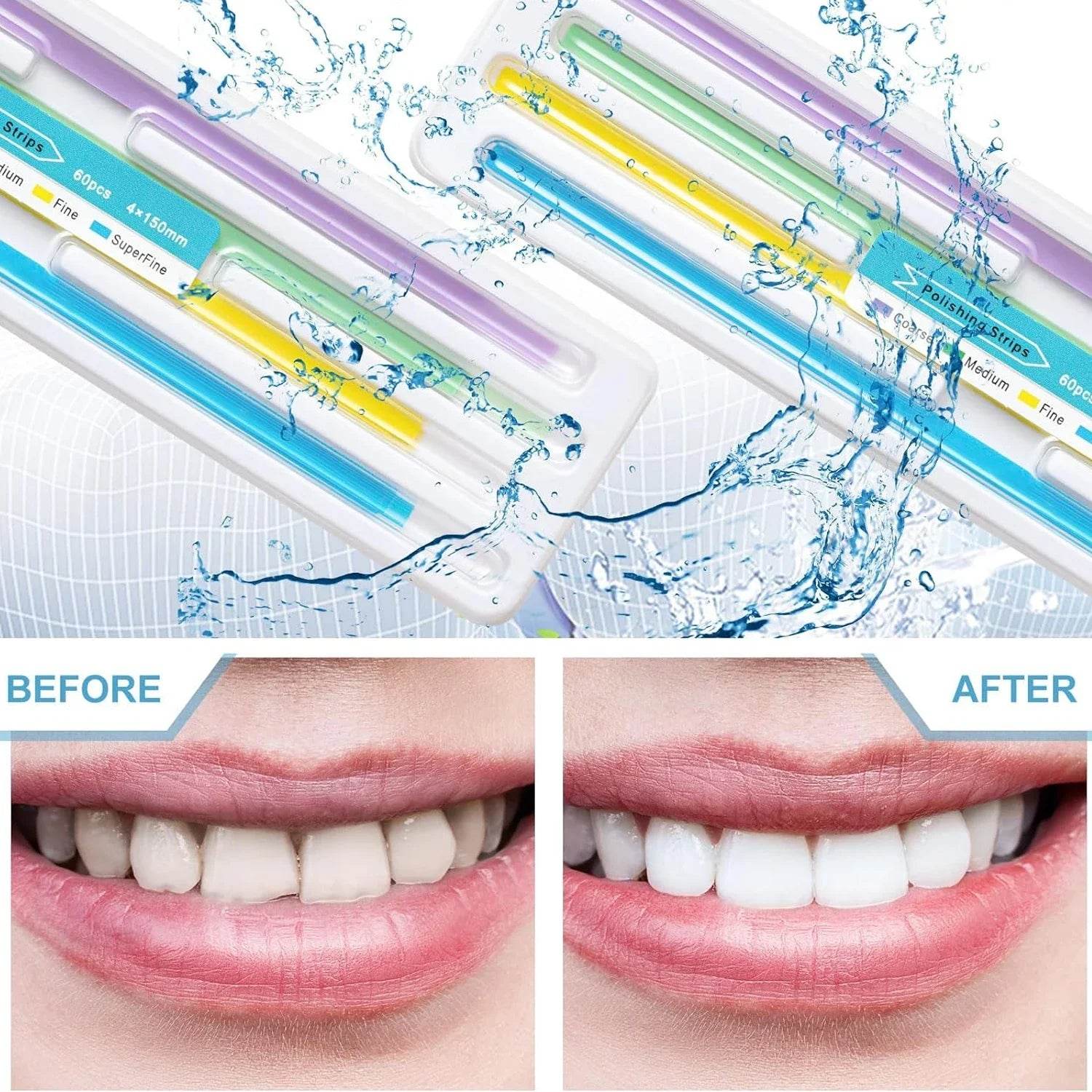 CYW807 Dental Polishing Strip - Denspay Dental - Universal Polishers & Abrasives