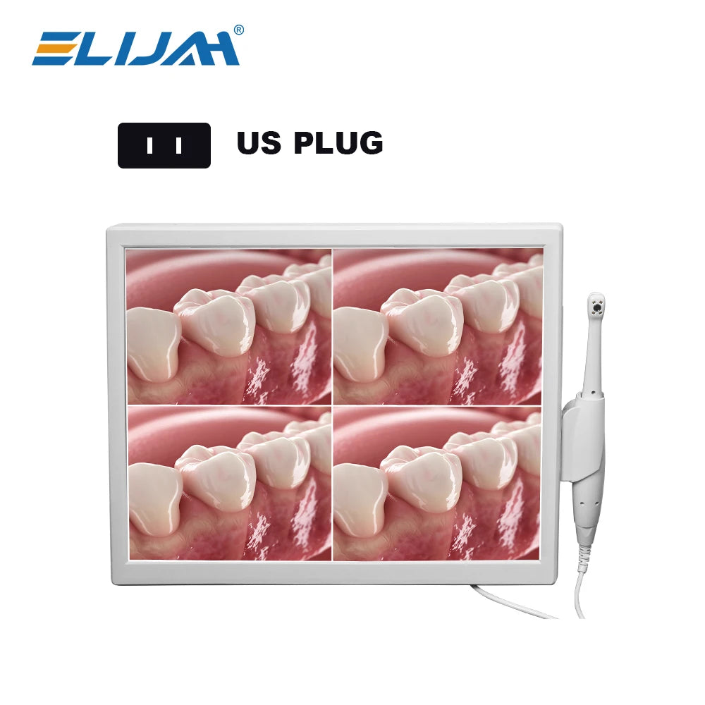 CYN077 Dental Intraoral Camera With Screen - Denspay Dental - Intraoral Camera