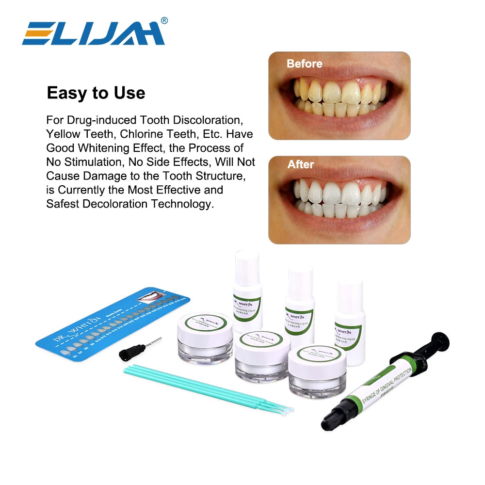 CYD050 Dental Whitening Kit - Denspay Dental - Whitening Materials