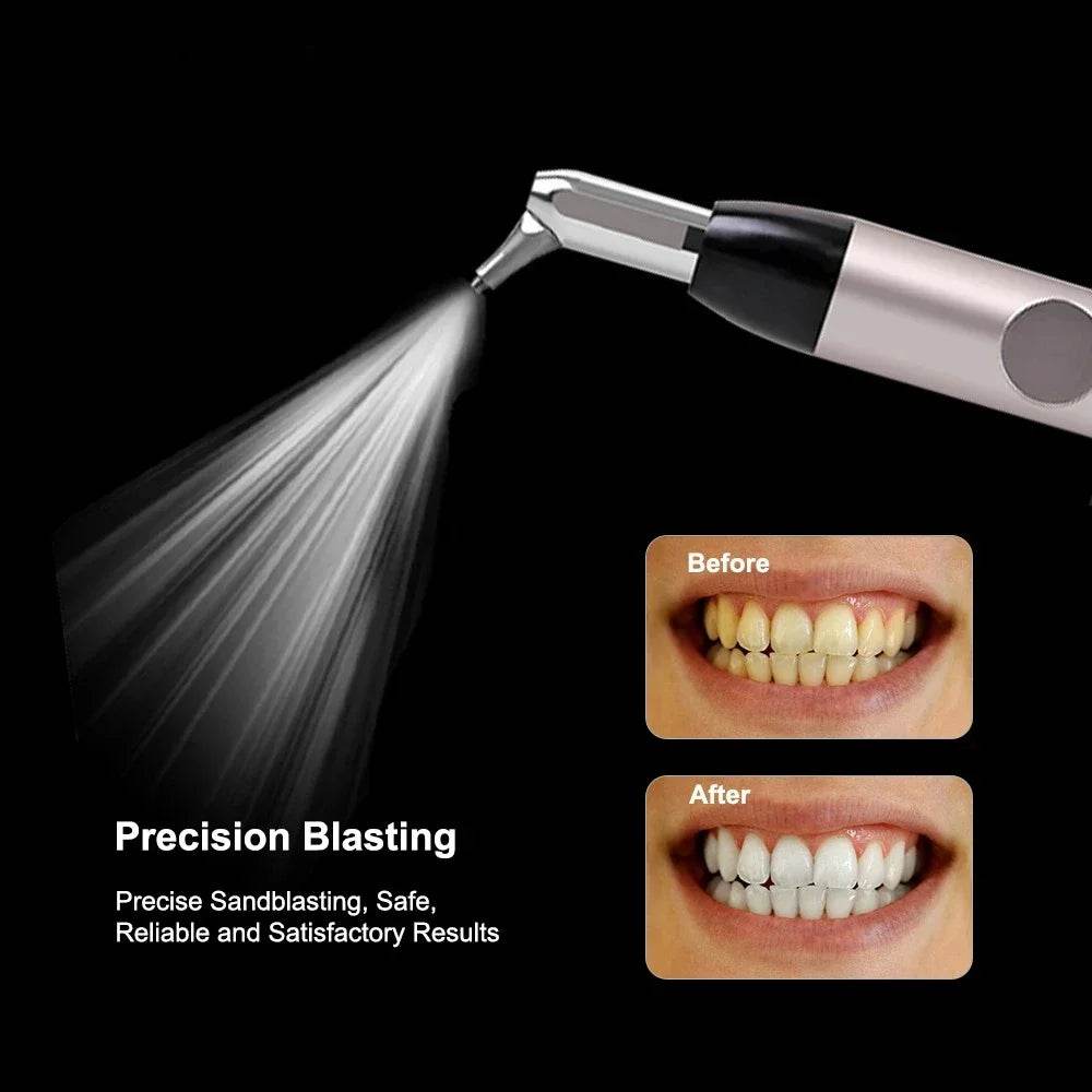 CYM029 Dental Aluminum Oxide Sandblasting Gun - Denspay Dental - Sandblasting Scaler