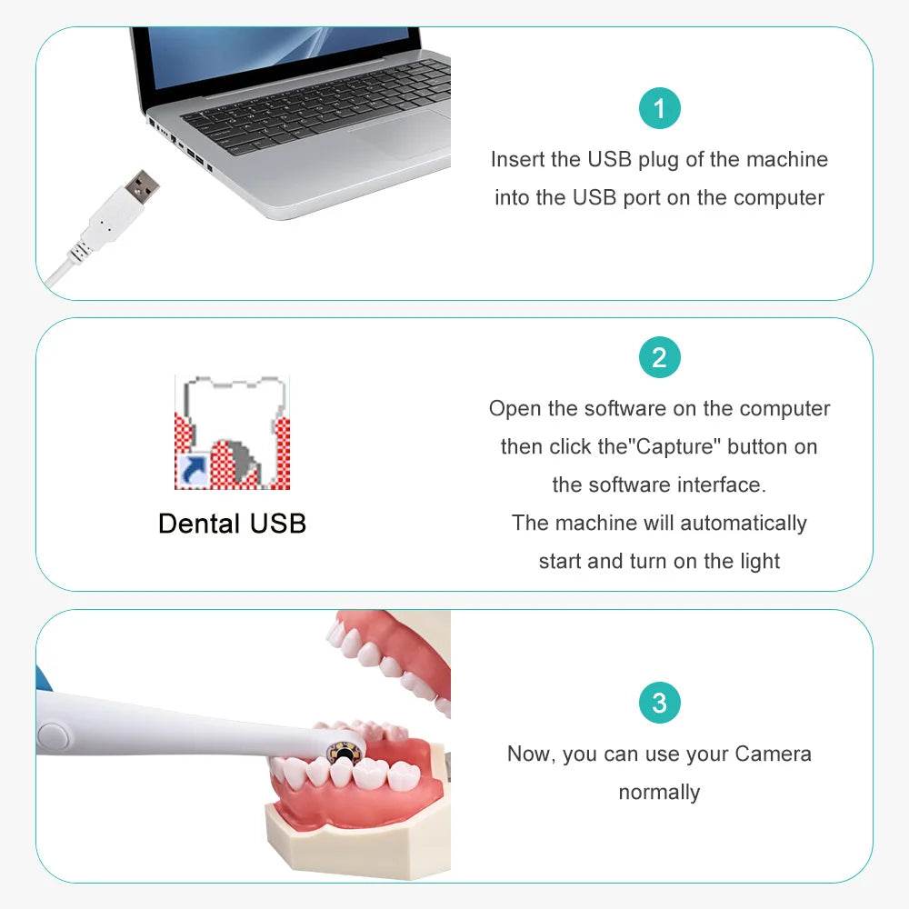CYN073 Dental LED Intra Oral Camera - Denspay Dental - Intraoral Camera