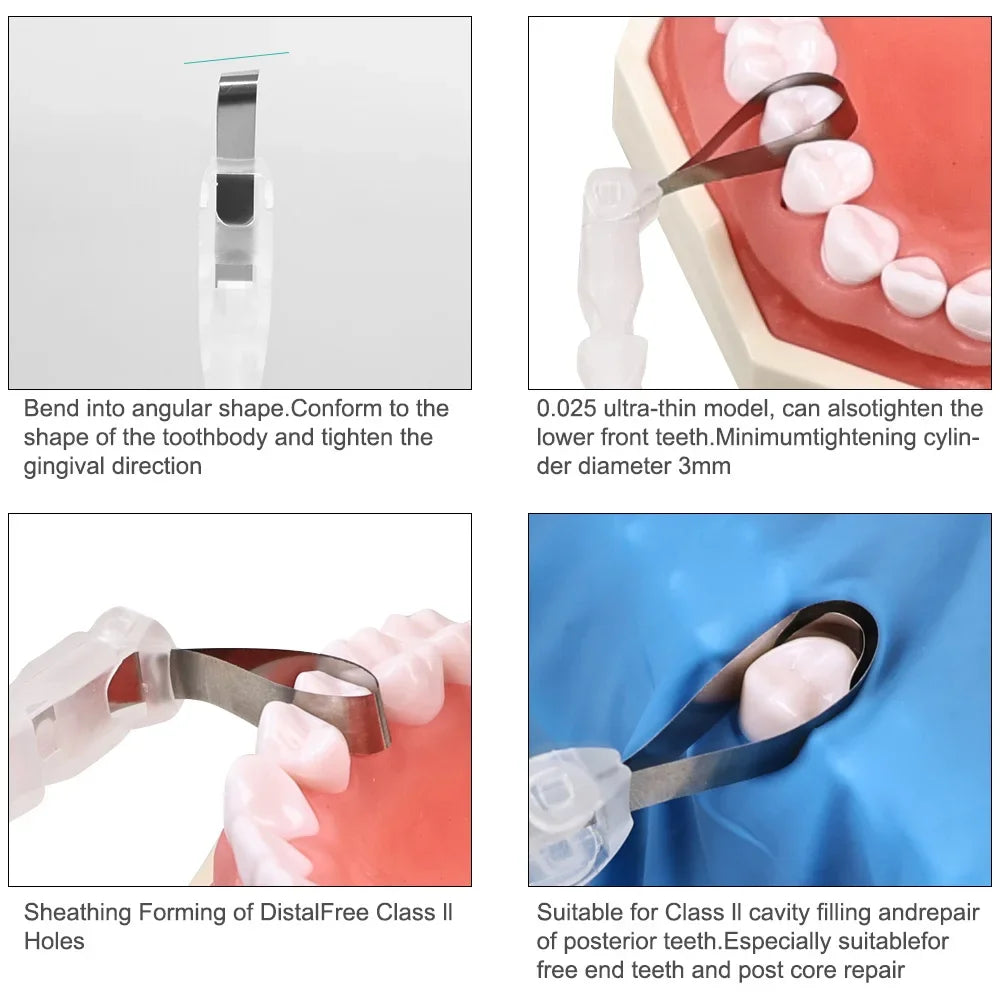 CYW741 Dental Pro Matrix Bands