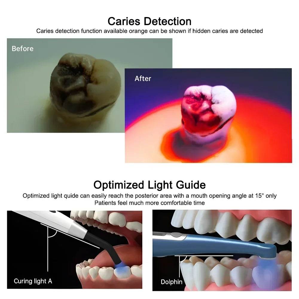 CYH069 Mecco Dolphin Curing Light - Denspay Dental - Curing Light