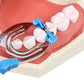 CYZ034 M2 Dental Matrix Bands