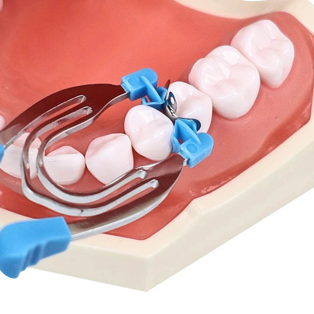 CYZ034 M2 Dental Matrix Bands - Denspay Dental - Matrix Bands & Clamp