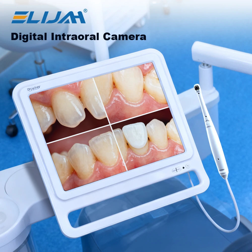 CYN076 Dental Intraoral Camera 17inch Quad Screen - Denspay Dental - Intraoral Camera