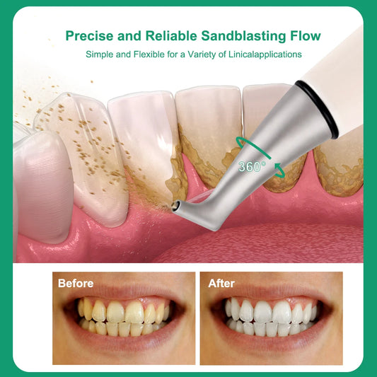 CYM025 Dental Air Polisher