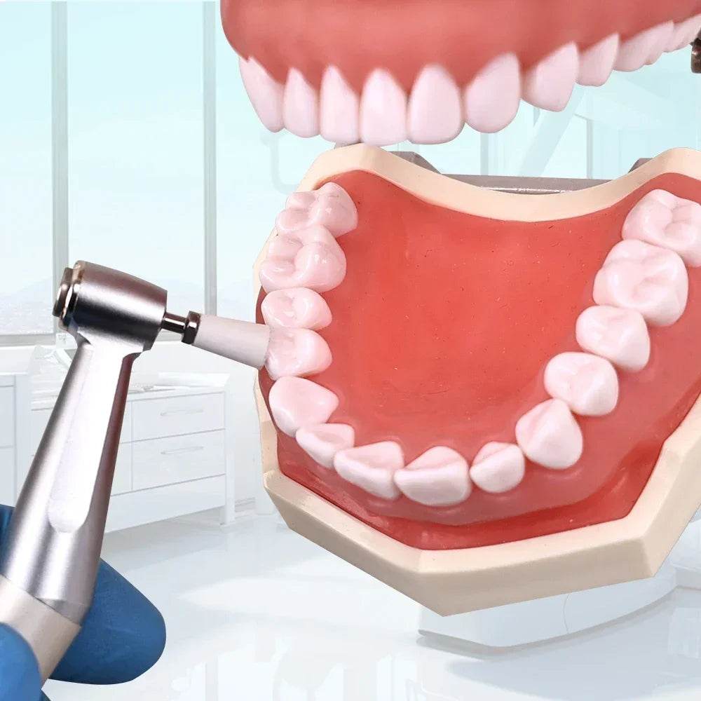 CYF308 Dental Silicone lon Polishing Kit - Denspay Dental - Resin Polishing