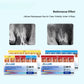 CYF335 Dental Pro-T Gutta Percha Points