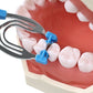 CYZ034 M2 Dental Matrix Bands