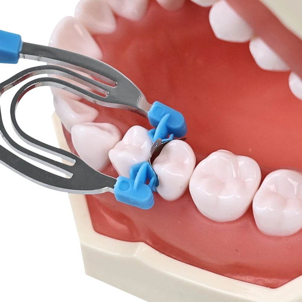 CYZ034 M2 Dental Matrix Bands - Denspay Dental - Matrix Bands & Clamp