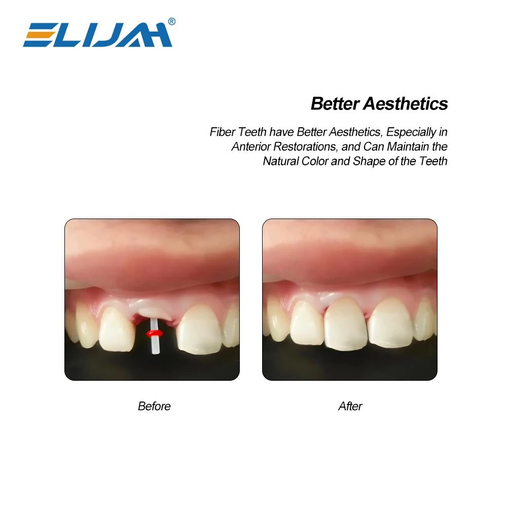 CYW849 Dental Fiber Post