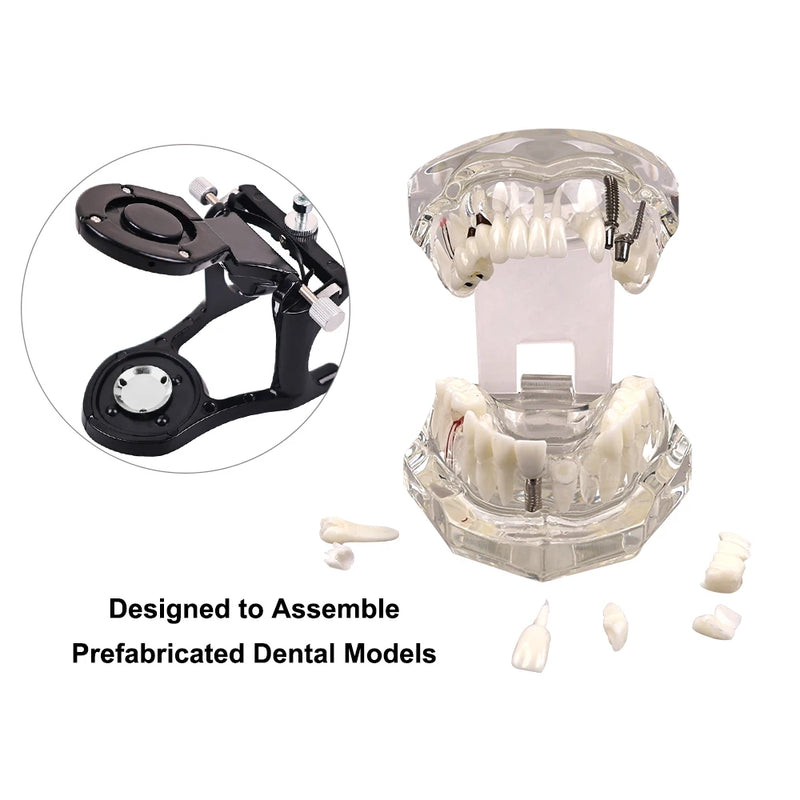Dental Implantation Disease Teeth Mode with Restoration Bridge Tooth  Dentist Training and Teaching Model for Dental Implant