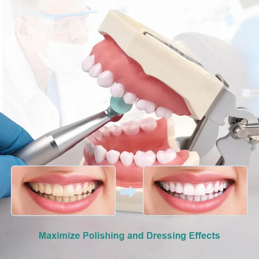 CYW797 Dental Polishing Discs - Denspay Dental - Universal Polishers & Abrasives