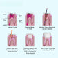 CYF335 Dental Pro-T Gutta Percha Points