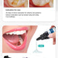 CYU195 DENTEX Dental Bonding Kits