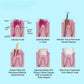 CYF337 Dental Gutta Percha Points - Denspay Dental - Gutta Percha Points