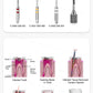 CYW837 Dental Screw Posts