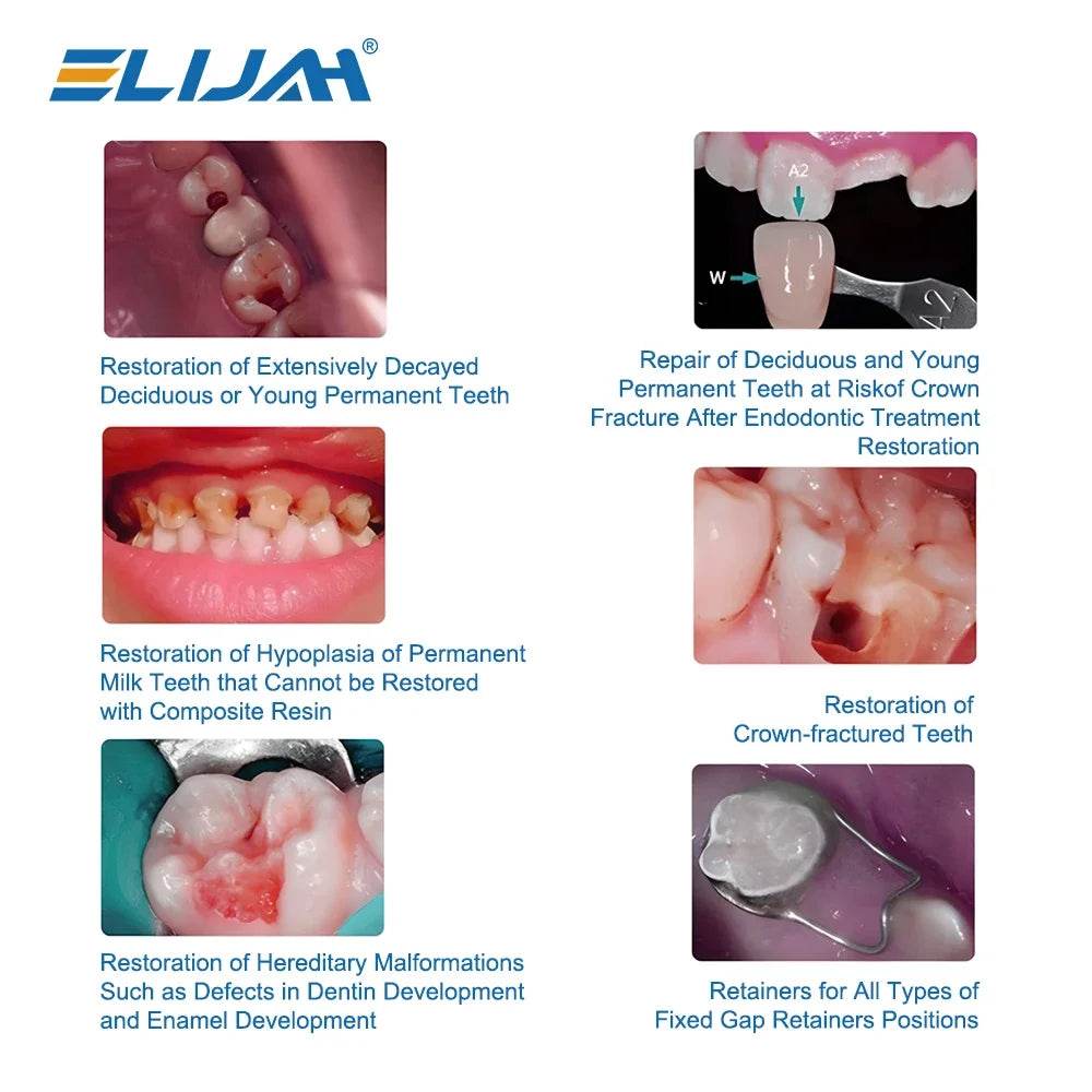 CYW840 Dental Kid Crowns - Denspay Dental - Dental Crown