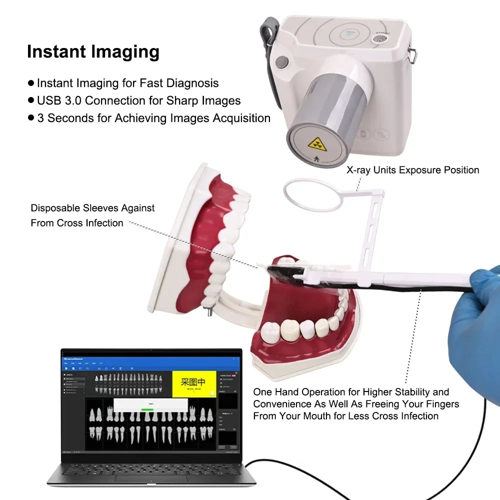 CYG076 Dental Portable X-Ray Unit - Denspay Dental - Intraoral X-Ray Machine