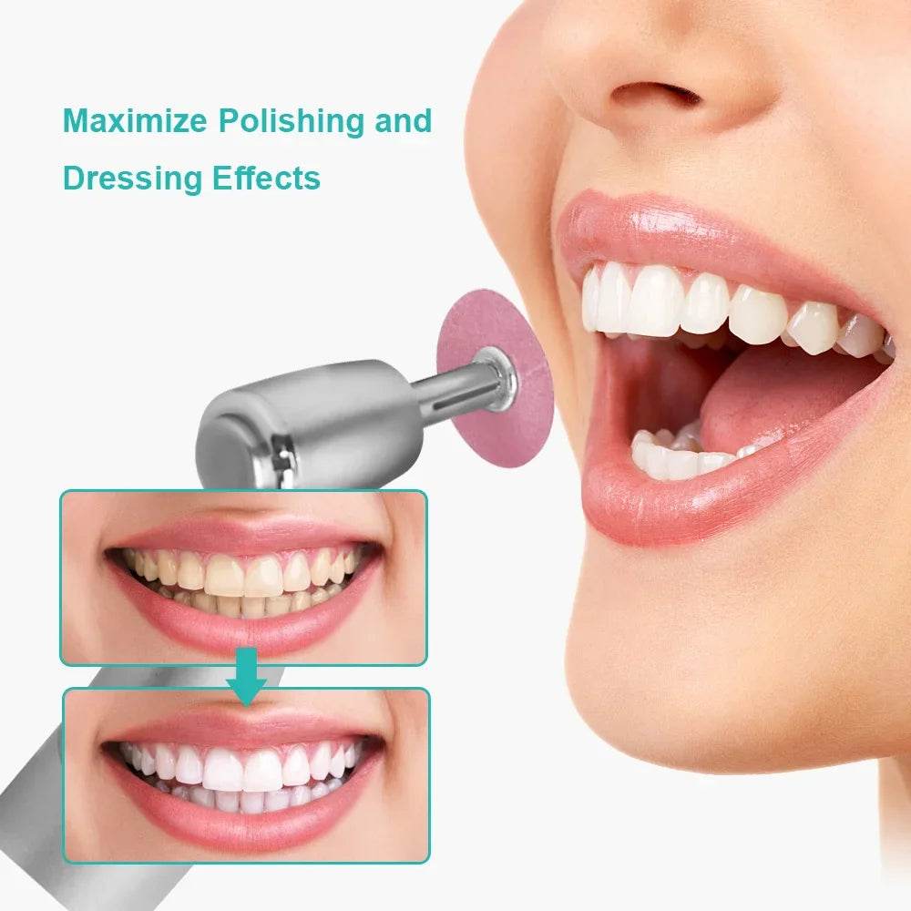 CYW866 Dental Polishing Discs - Denspay Dental - Universal Polishers & Abrasives