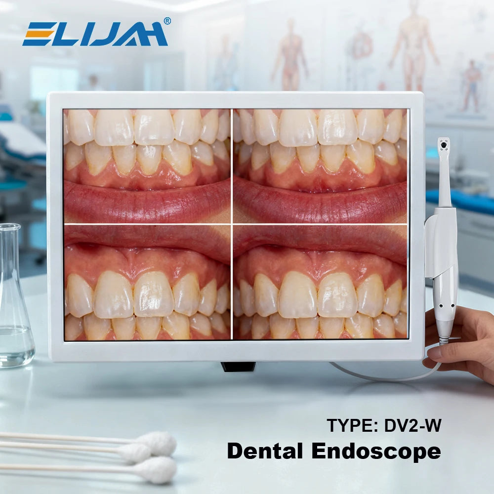 CYN077 Dental Intraoral Camera With Screen - Denspay Dental - Intraoral Camera