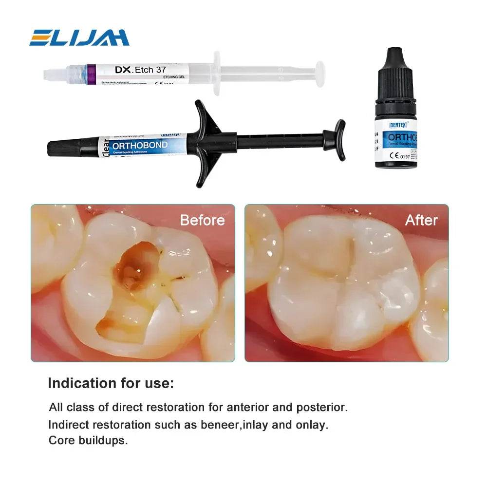 CYU195 DENTEX Dental Bonding Kits - Denspay Dental - Composite Resin