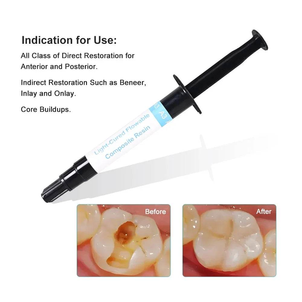 CYU199 Dental Flowable Composite Resin - Denspay Dental - Composite Resin