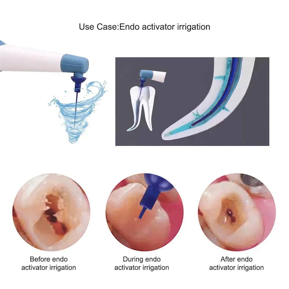 CYE068 Endo Ultrasonic Activator - Denspay Dental - Endo Ultra Activator