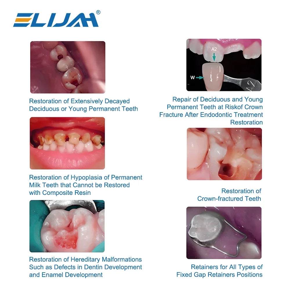 CYW839 10Pcs Dental Metal Crown 48 Sizes - Denspay Dental - Dental Crown