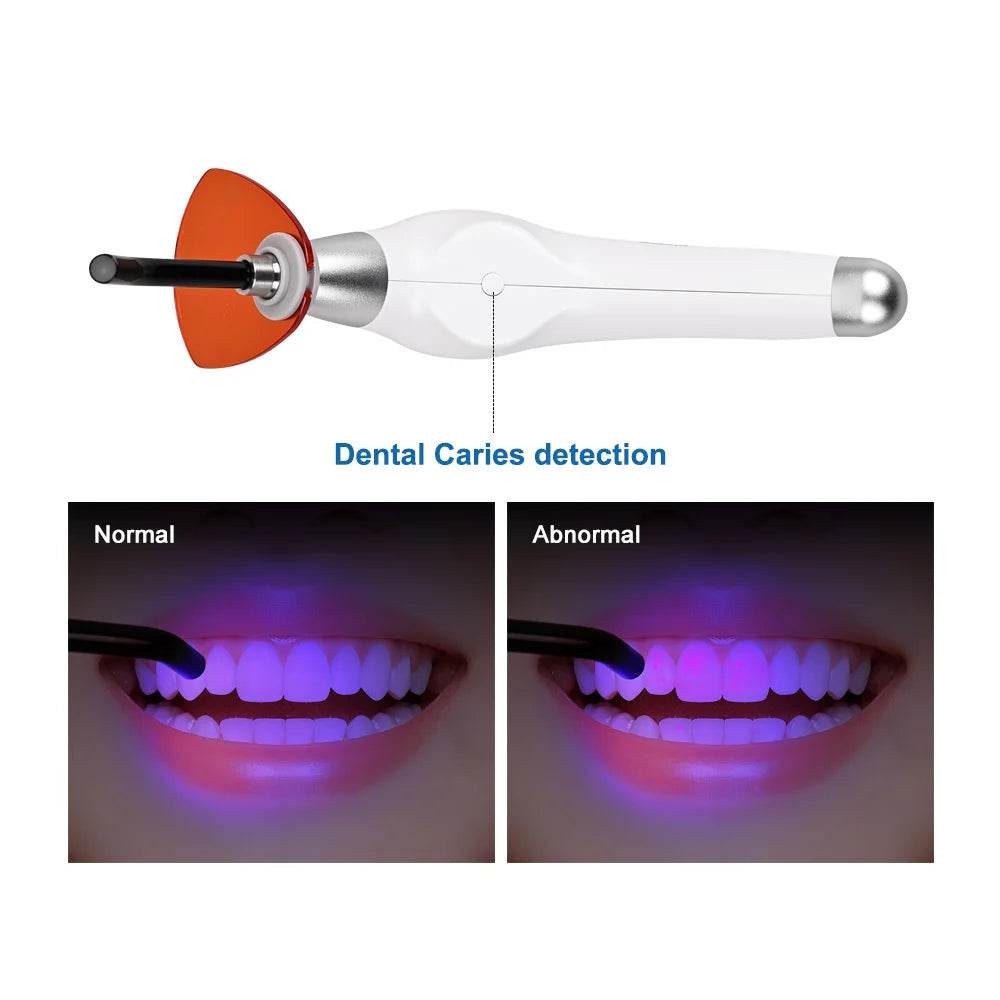CYH077 Dental LED Curing Light 5s Fast - Denspay Dental - Curing Light