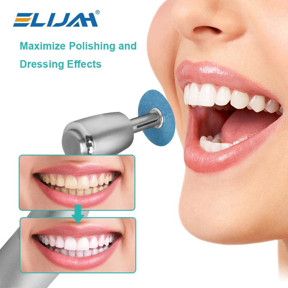 CYW069 Dental Polishing Discs - Denspay Dental - Universal Polishers & Abrasives